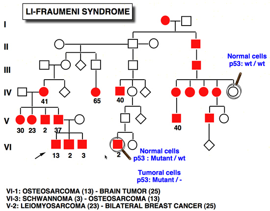 p53_cancer_Li_Fraumeni